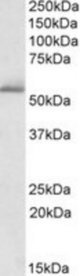 PDE1A antibody (1 ug/ml) staining of Human Cerebellum lysate (35 ug protein/ml in RIPA buffer). Primary incubation was 1 hour. Detected by chemiluminescence.