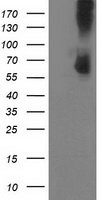 HEK293T cells were transfected with the pCMV6-ENTRY control (Left lane) or pCMV6-ENTRY PDE1B (Right lane) cDNA for 48 hrs and lysed. Equivalent amounts of cell lysates (5 ug per lane) were separated by SDS-PAGE and immunoblotted with anti-PDE1B.