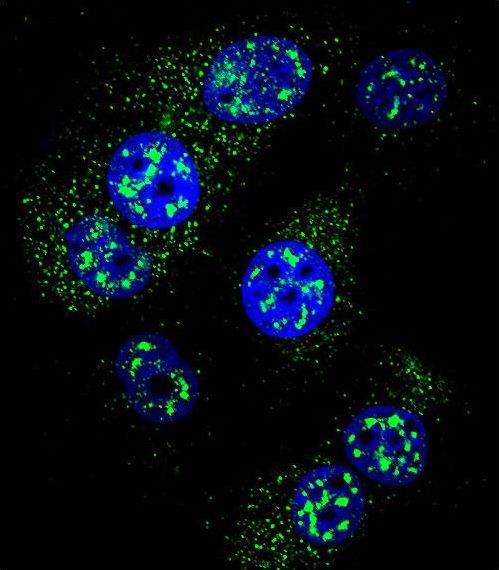 Confocal immunofluorescent of MGMT Antibody with MCF-7 cell followed by Alexa Fluor 488-conjugated goat anti-rabbit lgG (green). DAPI was used to stain the cell nuclear (blue).