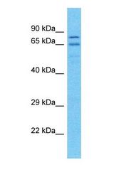 Western blot of PDE1C Antibody with human Placenta lysate.