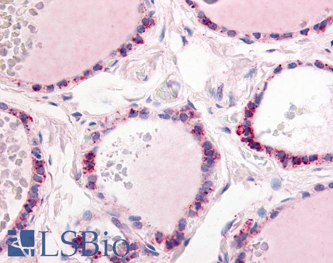 Anti-PDE1C antibody LS-A737 IHC of human thyroid. Immunohistochemistry of formalin-fixed, paraffin-embedded tissue after heat-induced antigen retrieval.