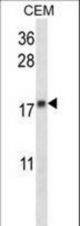 MGMT Antibody western blot of CEM cell line lysates (35 ug/lane). The MGMT antibody detected the MGMT protein (arrow).