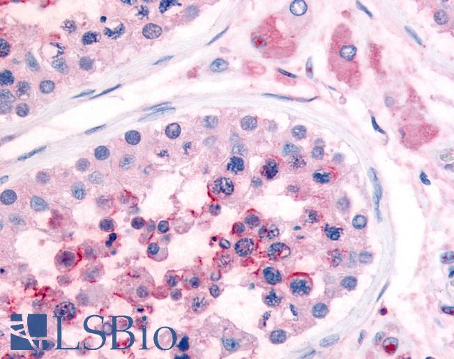 Anti-PDE3A antibody LS-A731 IHC of human testis. Immunohistochemistry of formalin-fixed, paraffin-embedded tissue after heat-induced antigen retrieval.
