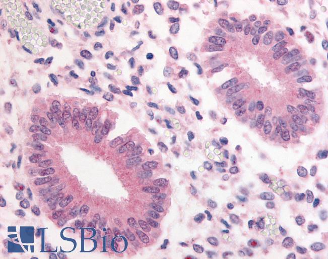Anti-PDE3A antibody LS-A749 IHC of human uterus. Immunohistochemistry of formalin-fixed, paraffin-embedded tissue after heat-induced antigen retrieval.