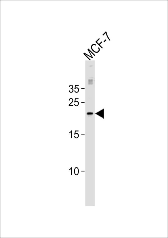 MGMT Antibody western blot of MCF-7 cell line lysates (35 ug/lane). The MGMT antibody detected the MGMT protein (arrow).