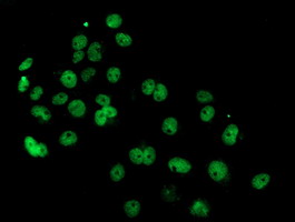 Anti-PDE4B mouse monoclonal antibody immunofluorescent staining of COS7 cells transiently transfected by pCMV6-ENTRY PDE4B.