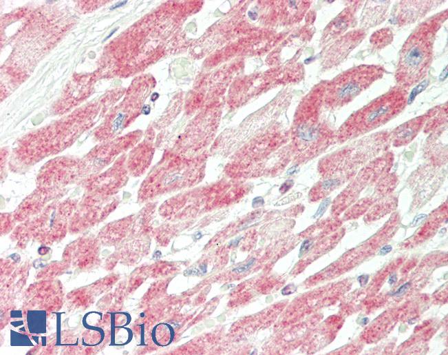 Human Heart: Formalin-Fixed, Paraffin-Embedded (FFPE)