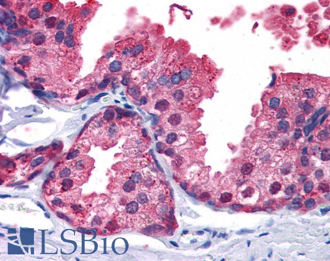 Anti-PDE4B antibody IHC of human prostate. Immunohistochemistry of formalin-fixed, paraffin-embedded tissue after heat-induced antigen retrieval. Antibody LS-B3942 concentration 5 ug/ml.