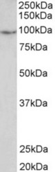 PDE4B antibody 2 ug/ml) staining of Human Uterus lysate (35 ug protein in RIPA buffer). Primary incubation was 1 hour. Detected by chemiluminescence.