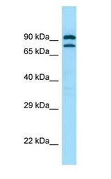 PDE4C antibody Western Blot of Fetal Lung.