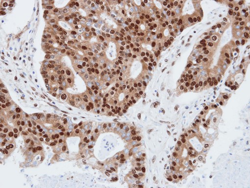 IHC of paraffin-embedded endo mitral using PDE4C antibody at 1:100 dilution.