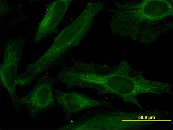 Immunofluorescence of monoclonal antibody to PDE4C on HeLa cell . [antibody concentration 10 ug/ml]