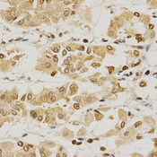 Immunohistochemistry of paraffin-embedded human stomach using PDE4D antibody at dilution of 1:200 (x400 lens)