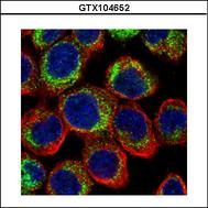 Confocal immunofluorescence analysis (Olympus FV10i) of paraformaldehyde-fixed A431 using PDE4D antibody (Green) at 1:500 dilution. Alpha-tubulin filaments were labeled with alpha-tubulin antibody (Red) at 1:500.