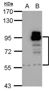 Sample (30 ug of whole cell lysate). A: A431, B: HeLa. 7.5% SDS PAGE. PDE4D antibody diluted at 1:1000.