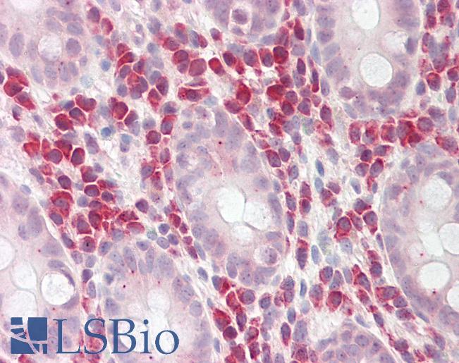Anti-PDE4D antibody IHC of human colon. Immunohistochemistry of formalin-fixed, paraffin-embedded tissue after heat-induced antigen retrieval. Antibody LS-B8230 dilution 2.5-5 ug/ml.