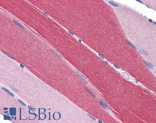 Anti-PDE4D antibody IHC of human skeletal muscle. Immunohistochemistry of formalin-fixed, paraffin-embedded tissue after heat-induced antigen retrieval. Antibody LS-B3940 concentration 5 ug/ml.