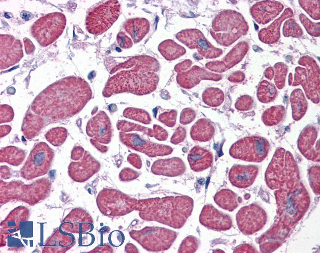 Anti-PDE4D antibody IHC of human heart. Immunohistochemistry of formalin-fixed, paraffin-embedded tissue after heat-induced antigen retrieval. Antibody LS-B3940 concentration 5 ug/ml.