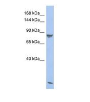 Western blot of Human Fetal Thymus. PDE6A antibody dilution 1.0 ug/ml.