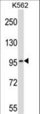 PDE6A Antibody western blot of K562 cell line lysates (35 ug/lane). The PDE6A antibody detected the PDE6A protein (arrow).