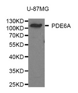 Western blot analysis of extracts of U-87MG cell line, using PDE6A antibody.