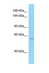 PDE6B / PDE6 Beta antibody LS-C146191 Western blot of 293T Cell lysate. Antibody concentration 1 ug/ml.