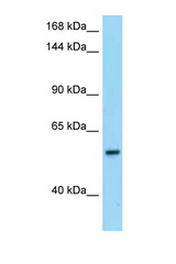 PDE6B / PDE6 Beta antibody LS-C146192 Western blot of Placenta lysate. Antibody concentration 1 ug/ml.
