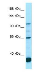 PDE6C antibody Western Blot of OVCAR-3.