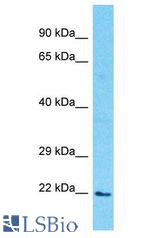 PDE6D / PDE6 Delta antibody Western Blot of 293T. Antibody dilution: 1 ug/ml.