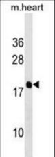PDE6D Antibody western blot of mouse heart tissue lysates (35 ug/lane). The PDE6D antibody detected the PDE6D protein (arrow).