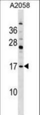 PDE6D Antibody western blot of A2058 cell line lysates (35 ug/lane). The PDE6D antibody detected the PDE6D protein (arrow).