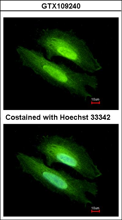 Immunofluorescence of methanol-fixed HeLa using PDE6D antibody at 1:500 dilution.