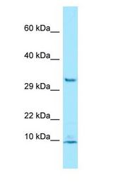 PDE6G / PDE6 Gamma antibody Western Blot of Jurkat.