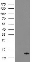 HEK293T cells were transfected with the pCMV6-ENTRY control (Left lane) or pCMV6-ENTRY PDE6G (Right lane) cDNA for 48 hrs and lysed. Equivalent amounts of cell lysates (5 ug per lane) were separated by SDS-PAGE and immunoblotted with anti-PDE6G.
