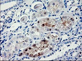 IHC of paraffin-embedded Human Kidney tissue using anti-PDE6G mouse monoclonal antibody.