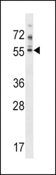 PDE7A Antibody western blot of NCI-H460 cell line lysates (35 ug/lane). The PDE7A antibody detected the PDE7A protein (arrow).