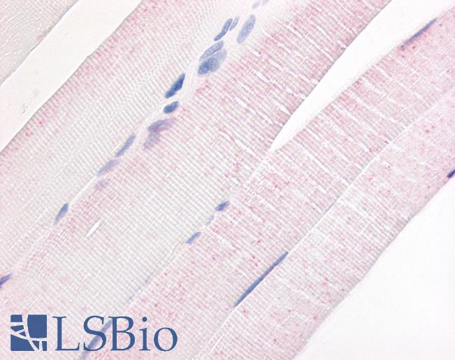 Anti-PDE7A antibody LS-A703 IHC of human skeletal muscle. Immunohistochemistry of formalin-fixed, paraffin-embedded tissue after heat-induced antigen retrieval.