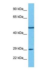 Western blot of PDE7B Antibody with human 786-0 Whole Cell lysate.