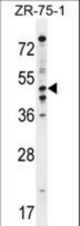 PDE7B Antibody western blot of ZR-75-1 cell line lysates (35 ug/lane). The PDE7B antibody detected the PDE7B protein (arrow).