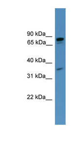 PDE8A antibody LS-C135468 Western blot of Fetal Heart lysate.