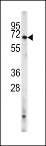 Western blot of PDE8A Antibody (L572) in HL60 cell line lysates (35 ug/lane). PDE8A (arrow) was detected using the purified antibody.