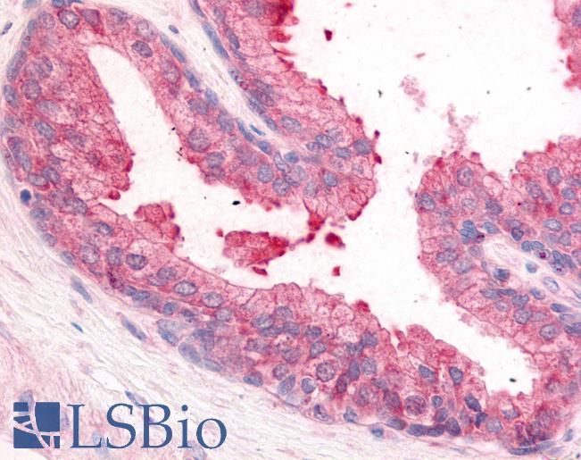 Anti-PDE8A antibody LS-A708 IHC of human prostate. Immunohistochemistry of formalin-fixed, paraffin-embedded tissue after heat-induced antigen retrieval.