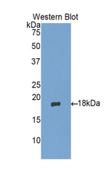 Western blot of recombinant MGP / Matrix Gla-Protein.