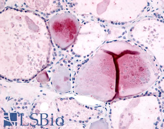 Anti-PDE8B antibody LS-A710 IHC of human thyroid. Immunohistochemistry of formalin-fixed, paraffin-embedded tissue after heat-induced antigen retrieval.