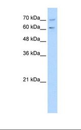 Jurkat cell lysate. Antibody concentration: 1.0 ug/ml. Gel concentration: 12%.