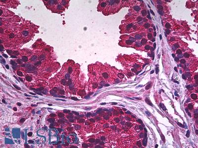 Anti-PDE9A antibody IHC of human prostate, epithelium. Immunohistochemistry of formalin-fixed, paraffin-embedded tissue after heat-induced antigen retrieval. Antibody LS-B5937 concentration 5 ug/ml.