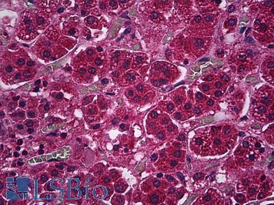 Anti-PDE9A antibody IHC of human adrenal cortex. Immunohistochemistry of formalin-fixed, paraffin-embedded tissue after heat-induced antigen retrieval. Antibody LS-B5937 concentration 5 ug/ml.