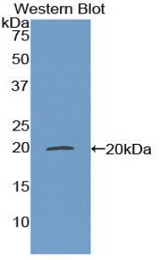 Western blot of recombinant MGP / Matrix Gla-Protein.