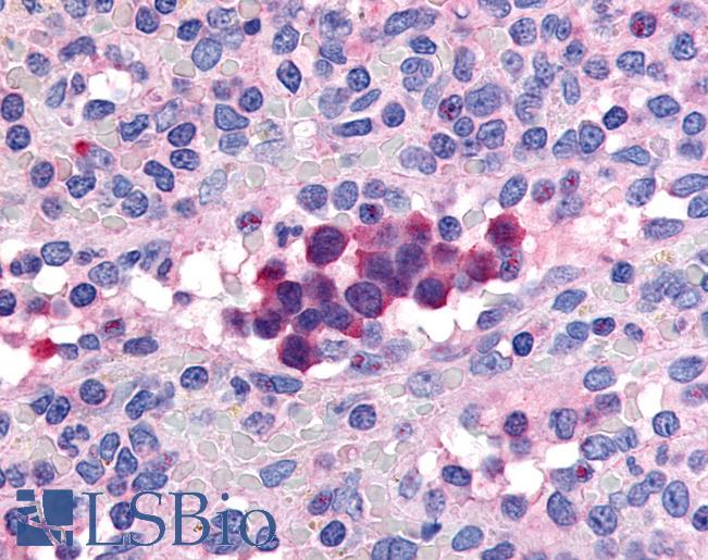 Anti-PDE9A antibody LS-A713 IHC of human spleen. Immunohistochemistry of formalin-fixed, paraffin-embedded tissue after heat-induced antigen retrieval.