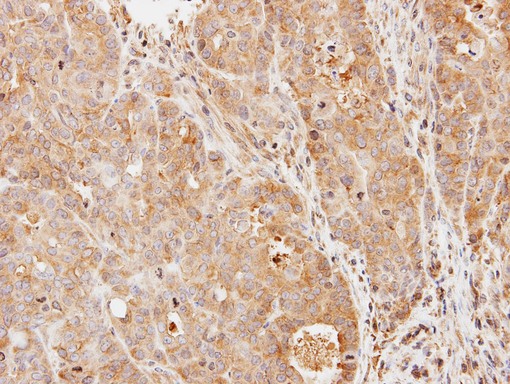 IHC of paraffin-embedded N87 xenograft using PDE9A antibody at 1:500 dilution.